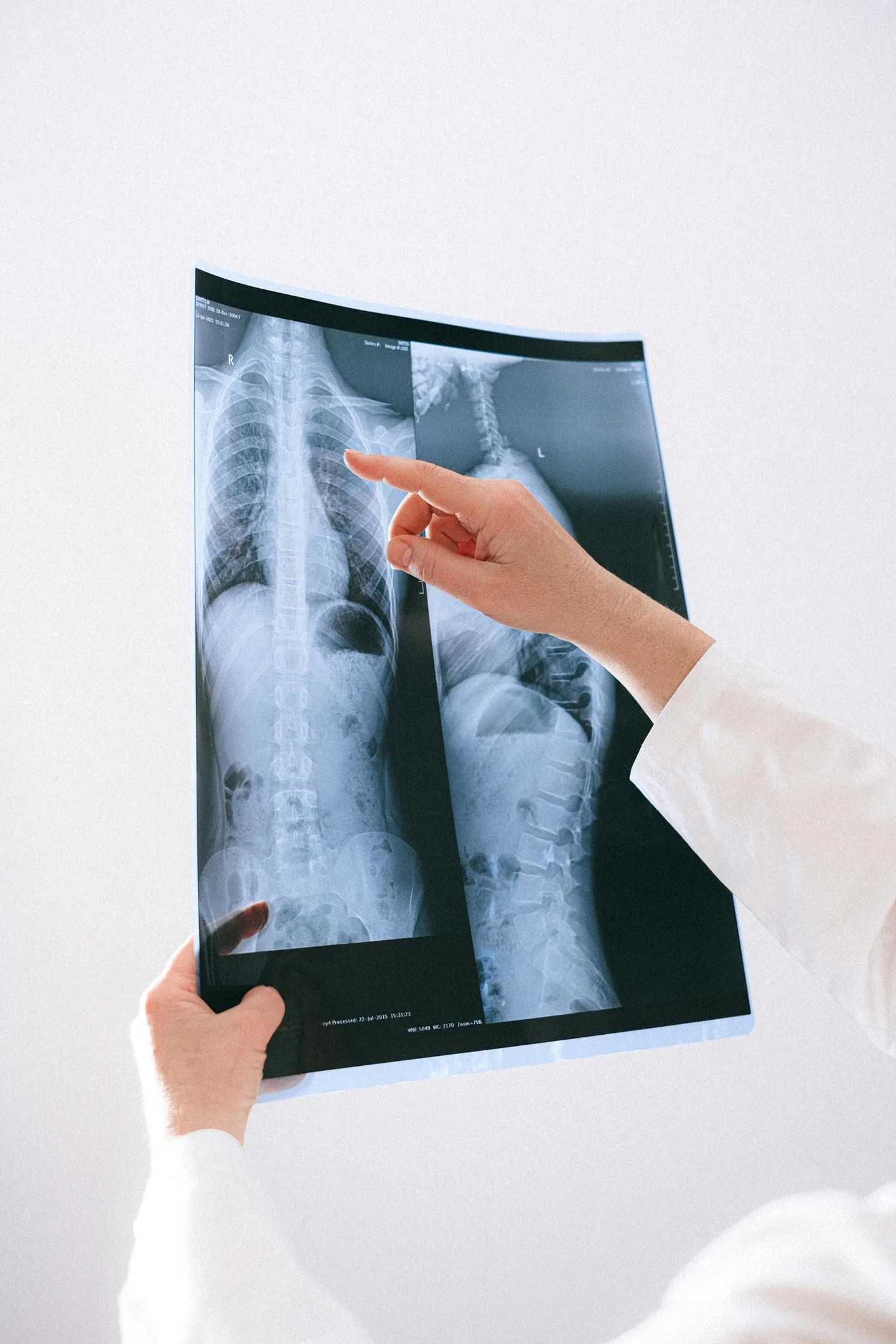 Doctor pointing at spine X-ray to explain posture and spinal health